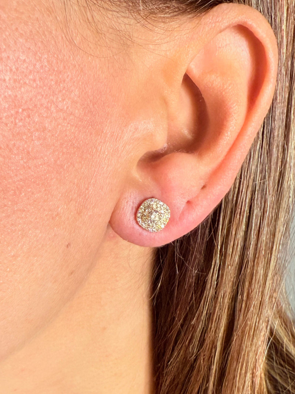 #Ear00152
